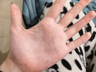 Женщина с черной точкой на руке — что это значит на самом деле