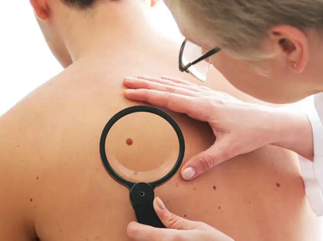 Почему появляются красные родинки