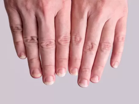 Посмотрите на свои ногти — сможете многое о себе узнать