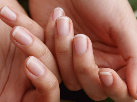Что означает белая лунка на ногте: ответ