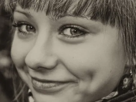 Почему с возрастом у женщин исчезают ямочки на щеках