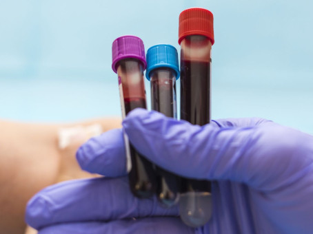 Скорую смерть можно предсказать по одному признаку