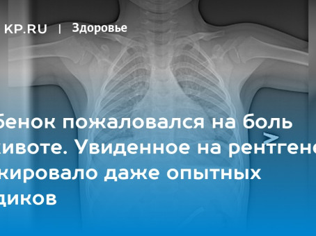 Ребенок пожаловался на боль в животе. Увиденное на рентгене шокировало даже опытных медиков