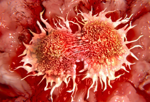 Вот откуда в теле берутся опухоли