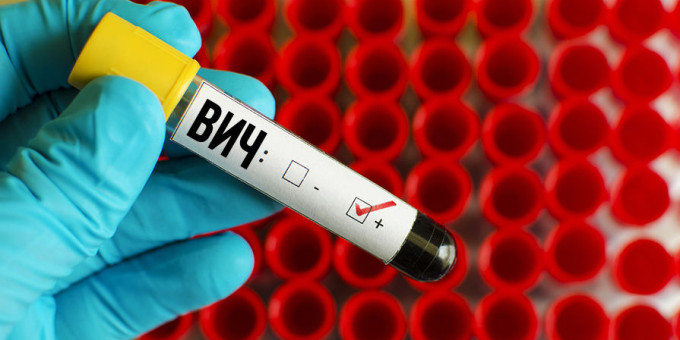 10 знаменитостей, которые живут с подтверждённым ВИЧ и не стыдятся в этом признаться