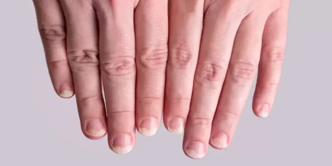 Посмотрите на свои ногти — сможете многое о себе узнать