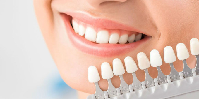 Самый простой способ отбелить зубы оказался прямо под рукой!