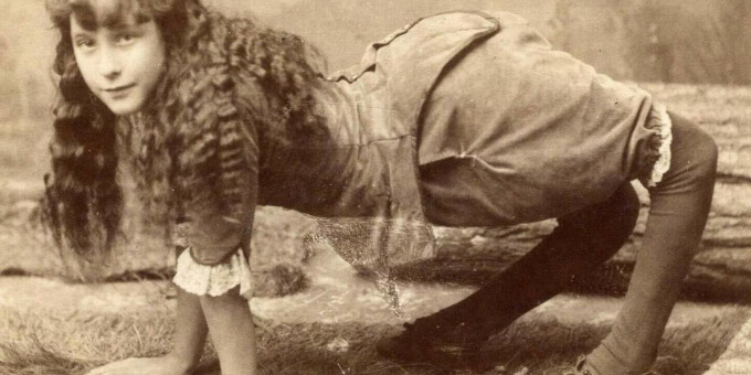 «Девочка-верблюд»: подлинная история Эллы Харпер