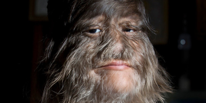 Как сложилась судьба девочки-волка