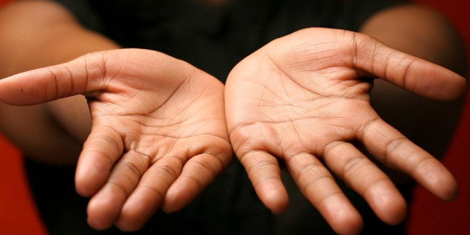 Если у вас на ладони есть буква Х, вот что она означает