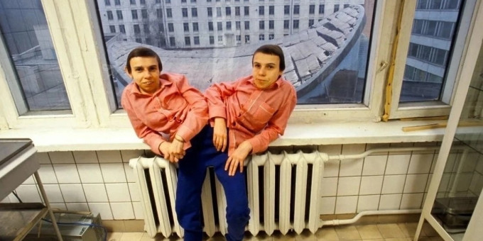 Сиамские близнецы Кривошляповы: что с ними стало