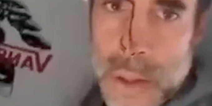 Пассажир рейса Flydubai заявил, что на борту самолета были нападавшие