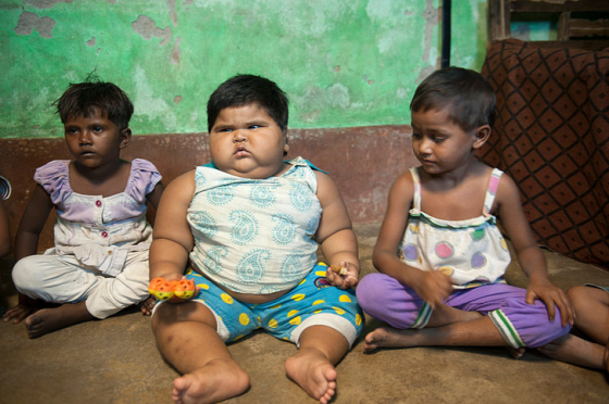 «400 кг и больше»: как выглядят самые толстые люди в мире