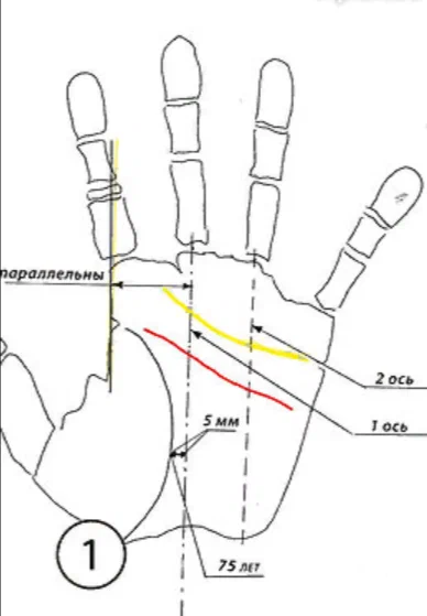 Этот знак на руке бывает только у долгожителей — срочно проверьте